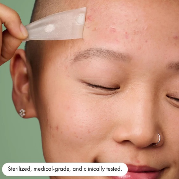 Hero Mighty Patch Surface - Picture 5 of 10